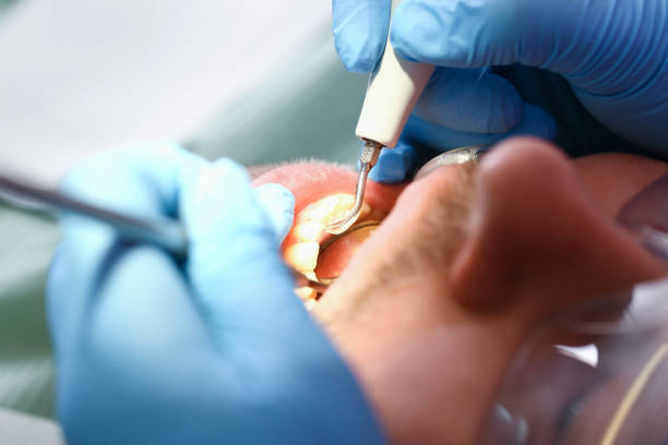 Best Broken or Chipped Tooth Repair in Ellsworth, ME